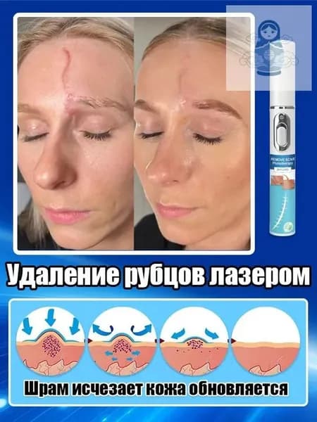 Лазерная ручка для удаления шрамов, используемая для удаления шрамов, растяжек, травм и пигментации, устранения рубцов, восстановления гладкости кожи и быстрого заживления. одна лазерная ручка