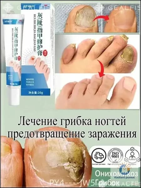 При грибке ногтей ног, 20 г, мазь Ноготок, восстанавливает и укрепляет