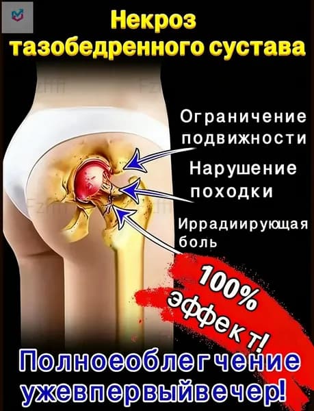 Китайский эффективный пластырь для лечения некроза тазобедренного сустава 100%