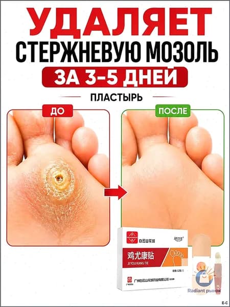Качественный пластырь для удаления бородавок, стержневых мозолей и натоптышей, 12 штук