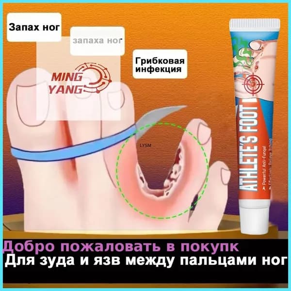 Средство от запаха ног для зуда и язв между пальцами, против грибка, дезодорант эффективное 20г