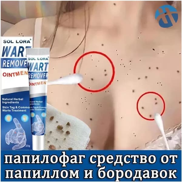 Крем для выведения бородавок