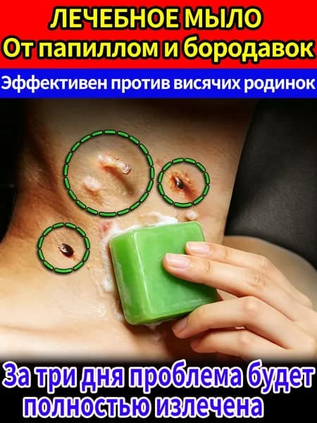 Лечебное мыло от папиллом и бородавок на теле натуральное безболезненное удаление быстрый результат
