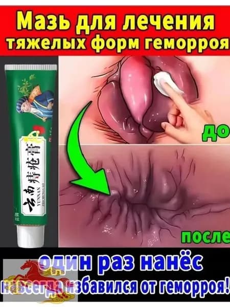 Чудодейственный восстанавливающий крем для устранения геморроя и опухолей, способствующий заживлению анальных трещин и устранению зуда;