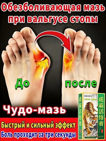 мазь от косточки на большом пальце, от шишек на больших пальцах ног