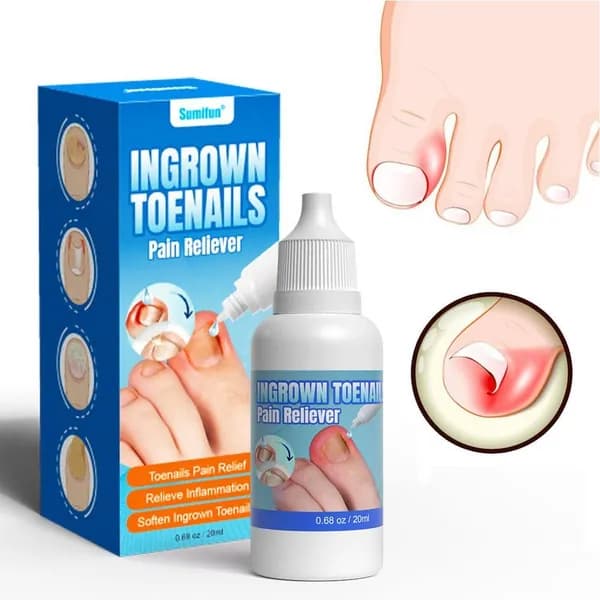 20ML Капли для смягчения ногтей на ногах, подходят для лечения паронихии