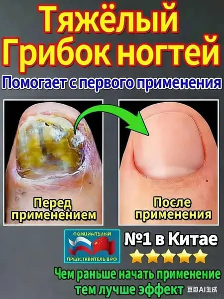 мазь ноготок от грибка ногтей на ногах,Лечите грибковые инфекции, укрепляйте и восстанавливайте ногти и роговой слой кожи, а также устраняйте грибок ногтей на ногах.