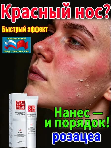 Крем от розацеа на лице купероза и покраснений 20 г, уменьшает покраснение и припухлость носа, гиперемию и жирность кожи