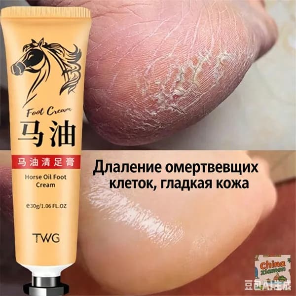 30 Г Крем Для Ног Против Трещин, Восстанавливает Потрескавшиеся Пятки, Удаляет Омертвевшую Кожу И Мозоли, Предотвращая Сухость, Ухаживает За Кожей Рук И Ног.1 шт