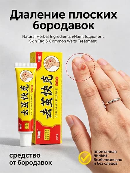 7 дней без следов удаление Мазь от бородавок, для рук, для шеи, чистотел от бородавки, от сухих мозолей 15мл