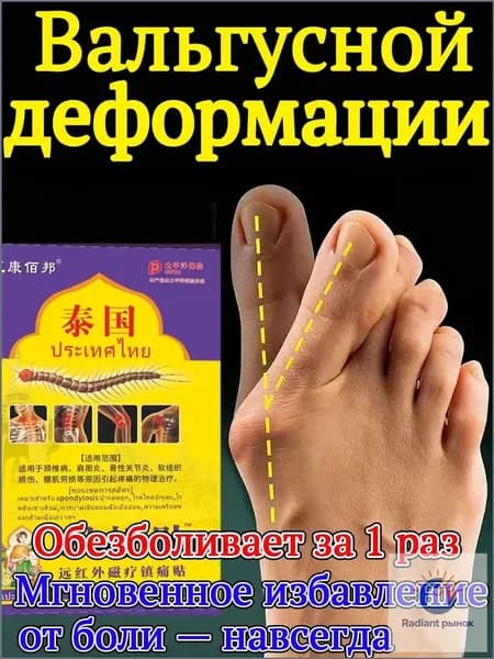 Корректор для лечения бурсита большого пальца, облегчение боли при вальгусной деформации, пластырь для ухода за стопами