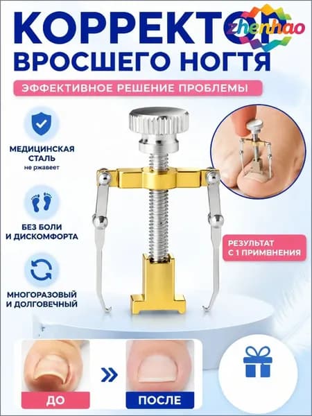 Коррекция вросших ногтей