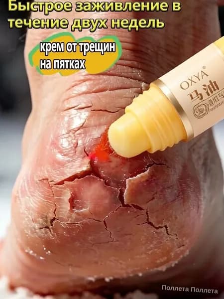 Крем воск от трещин для очень сухой кожи, ног с мочевиной 5%, на пятках, пяток