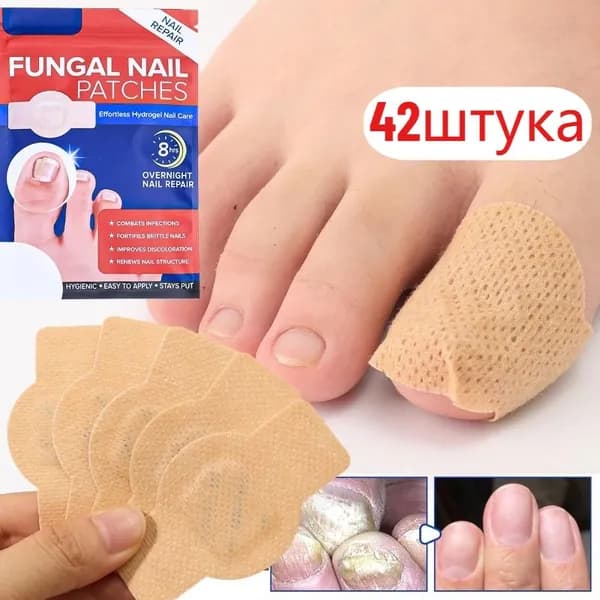 Пластыри для лечения онихомикоза,2 упаковка, 42 штука