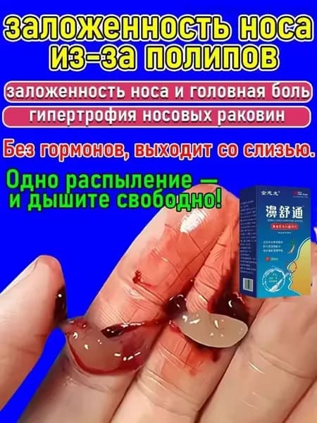 Спрей назальный от полипов в носу Снимает заложенность, зуд и насморк 20 мл