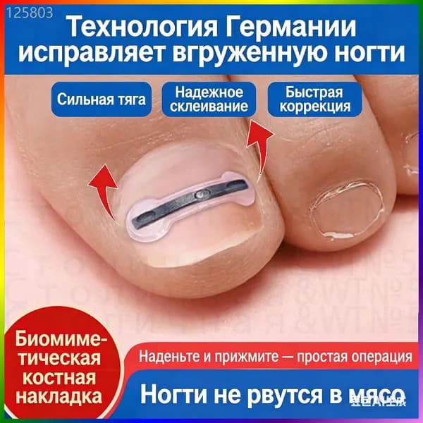 Набор для коррекции вросшего ногтя из никель-титанового сплава для домашнего лечения