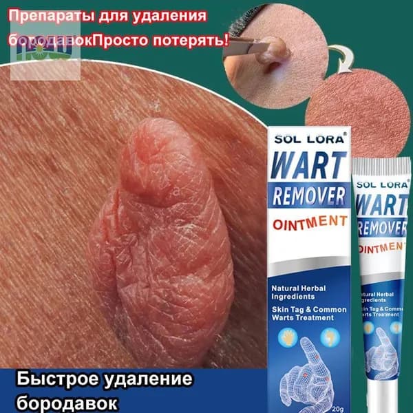 Мазь от бородавок, Крем средство для удаления бородавок, папиллом и родинок, безболезненно, не оставляет след