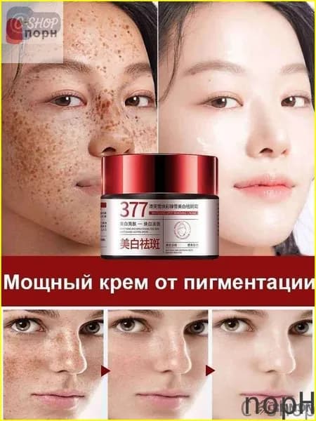 C-shop-Крем от пигментации для лица,30 г,эффективно удаляет веснушки,пигментные пятна солнечные ожоги,старческие пятна, натуральная формула с китайскими травами,восстанавливает кожу,осветляет тон кожи
