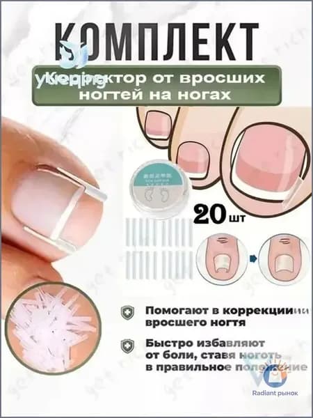 Корректор От Вросших Ногтей На Ногах1