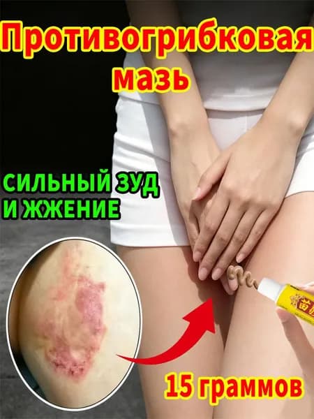 Противогрибковая мазь от пахового грибка для кожи 15г