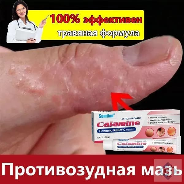 Противозудная мазь 20г от экземы и дерматита