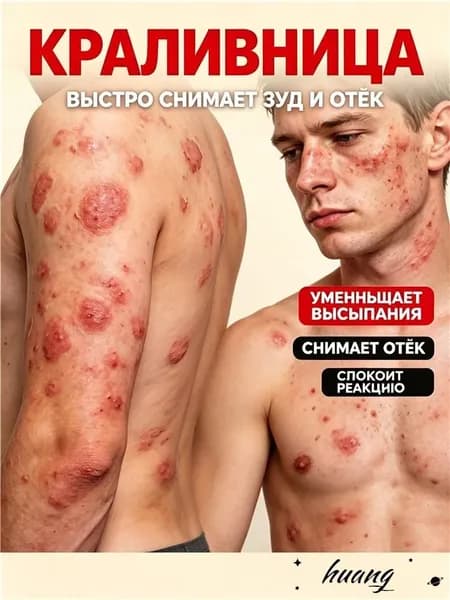 Быстро снимает зуд и отек, уменьшает сыпь и успокаивает кожные реакции.