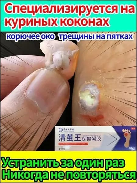 средство для удаления натоптышей на ногах.Быстрый эффект/20 г
