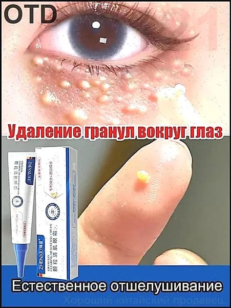 Эксклюзивный крем для век против жировиков, разглаживающий кожу и устраняющий дефекты, 30 г