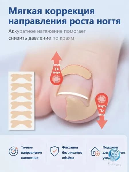Наклейки от вросшего ногтя,20 шт