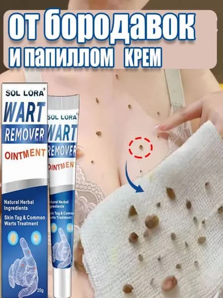 Крем от бородавок от папиллом, Для тела, для рук, для шеи, чистотел от папиллом, чистотел от бородавки, от сухих мозолей, криофарма от бородавок , 20 g