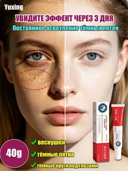 YUXING Крем для осветления веснушек, пигмента и темных кругов под глазами 20г 2шт