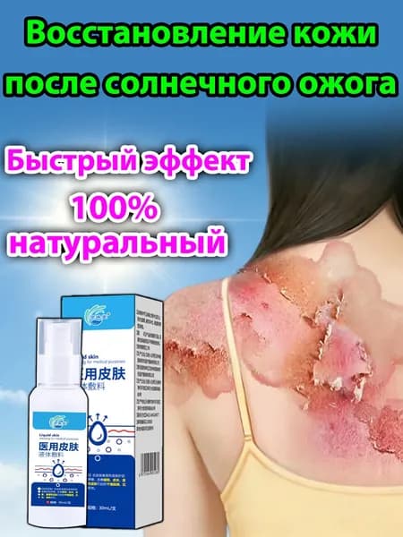 Крем для лечения солнечного дерматита,Восстановление кожи после солнечных ожогов крем после загара