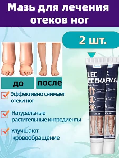 2 шт Мазь для снятия отека ног Лечение отеков и болей в ногах 20 г