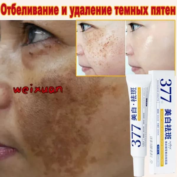 Отбеливающий крем против веснушек, 30г, против пигментации и пигментных пятен от веснушек , осветляющий и увлажняющий