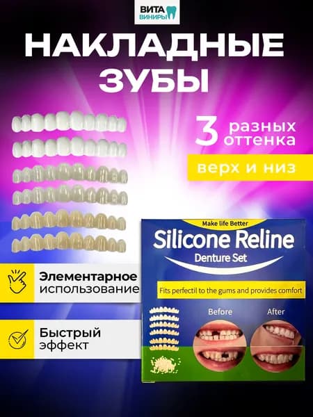 Набор для формирования накладных виниров