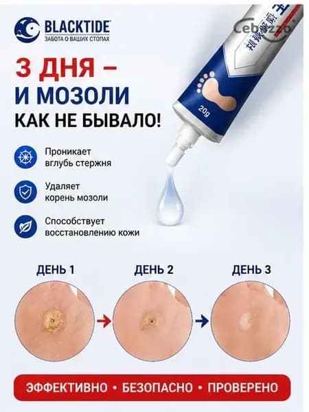 Средство от шипиц, натоптышей и сухих стержневых мозолей на ногах мазь и гель Корнекс,эффективное китайское средство