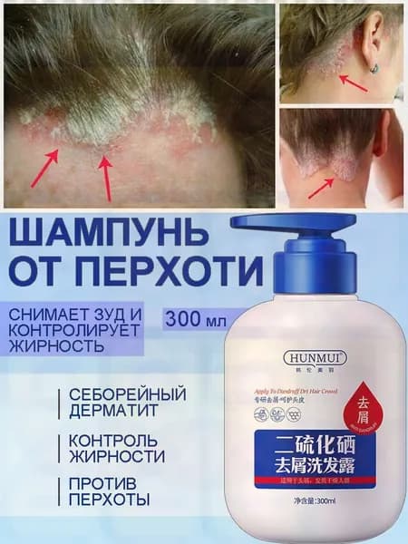 Шампунь для волос, 301 мл