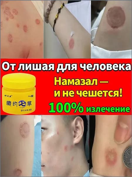Мазь от лишая на теле у человека