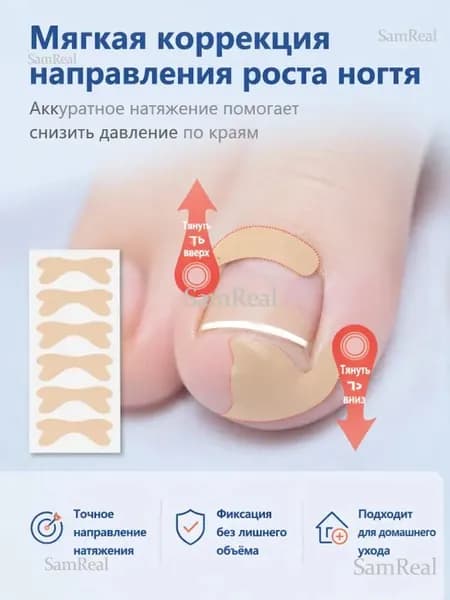 Наклейки от вросшего ногтя,20 шт