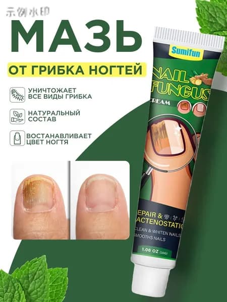 Средство от грибка ногтей на ногах эффективное, мазь от трещин, для пяток и стоп , крем противогрибковый, чудо средство для ухода за ногами , микозе .30мл