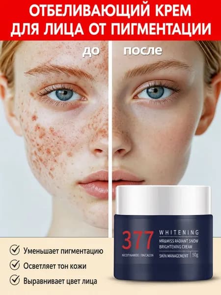 крем от пигментных пятен на лице, борется с веснушками, сильной пигментацией и возрастными пятнами, удаляет меланин, отбеливает и осветляет тон кожи,50 г