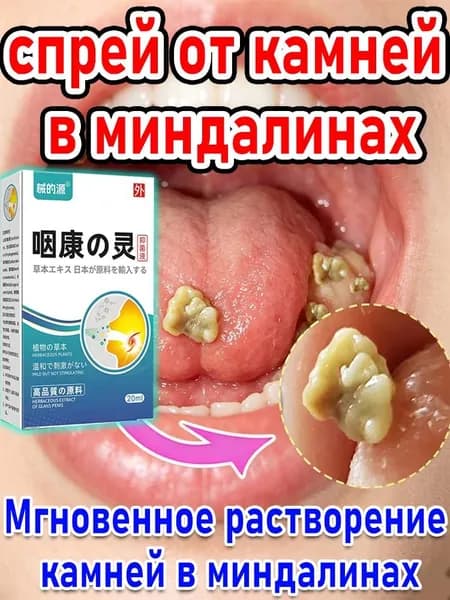 Набор для удаления тонзиллолитов и чистки миндалин