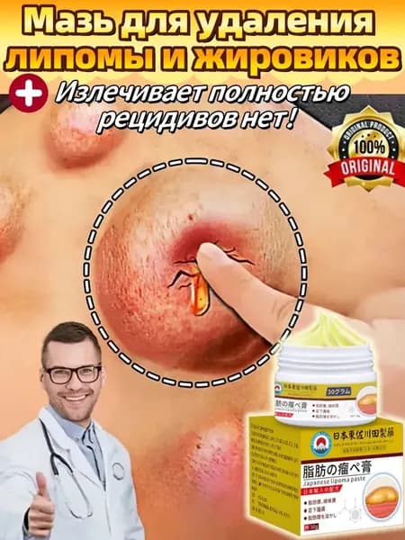 натуральный крем для удаления липомы Быстро удаляет подкожную липому, показан при отечности кожи,целлюлите,фиброзном жировике, 30 г