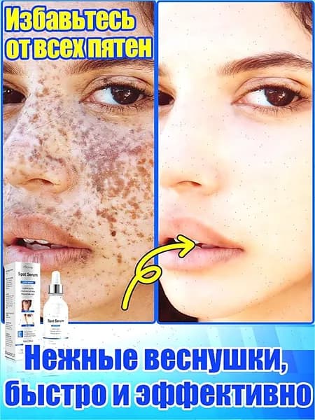 Отбеливающее и от веснушек эфирное масло, осветляет на 7 дней, аккуратно удаляет различные пигментные пятна, восстанавливает после пребывания на солнце, повышает тонус кожи, питает и увлажняет.