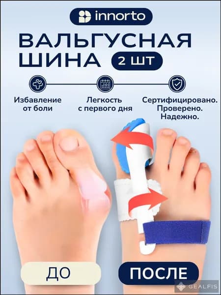 Вальгусный корректор для большого пальца. Ночной бандаж для коррекции косточки на ноге 35188