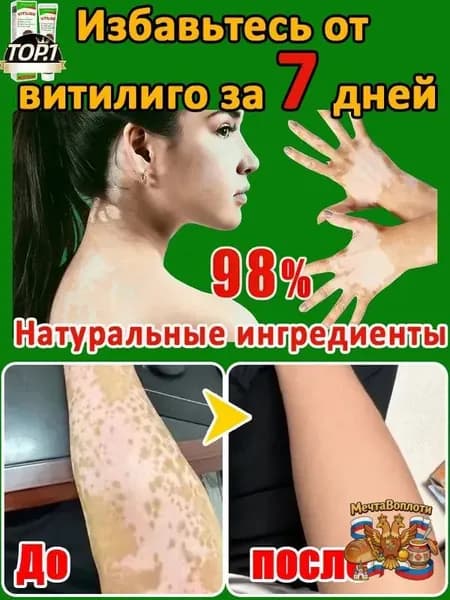 Мазь от витилиго,Средство при нежелательной пигментации витилиго.60 мл