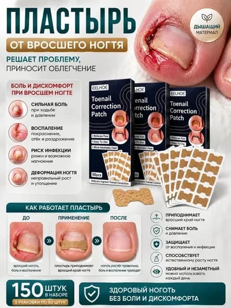 пластыри от врастания ногтей на ногах 3 упаковки
