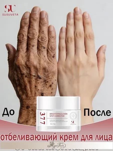 Kрем против пигментных пятен и веснушек,отбеливающий от пигментации,Ночной и дневной для кожи лица и тела,30г
