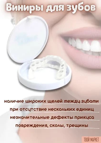 Виниры для зубов накладные