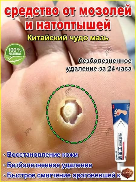Пластырь от мозолей, бородавок и натоптышей лечебный, быстрое смягчение, безболезненное удаление,20 г.